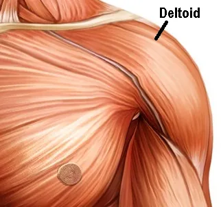 Self-paced Online Home Study 12 CE Myofascial & Neuromuscular Therapy