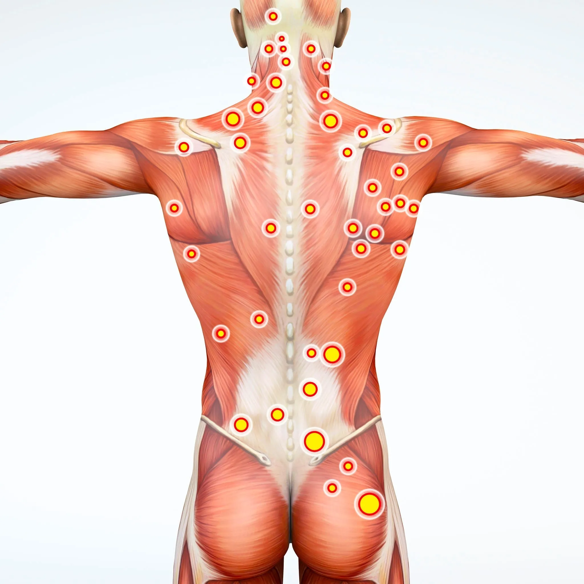Self-paced Online Home Study 12 CE Myofascial & Neuromuscular Therapy